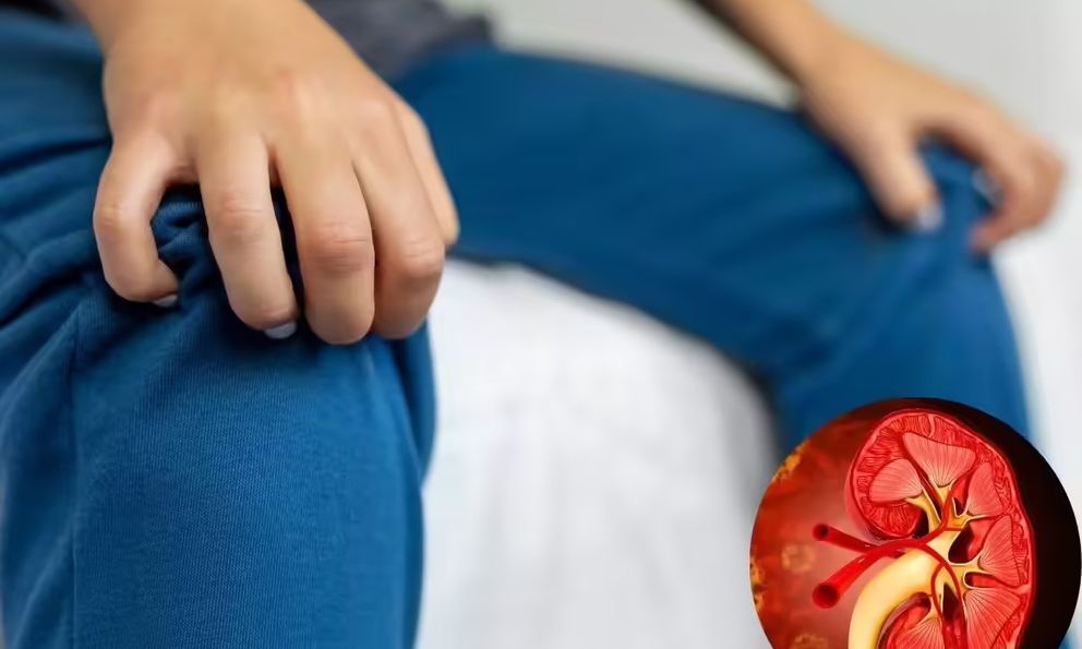 Muốn biết thận khỏe hay yếu, cứ nhìn vào tay và chân sẽ rõ: Có 7 dấu hiệu này thì phải đi khám sớm!