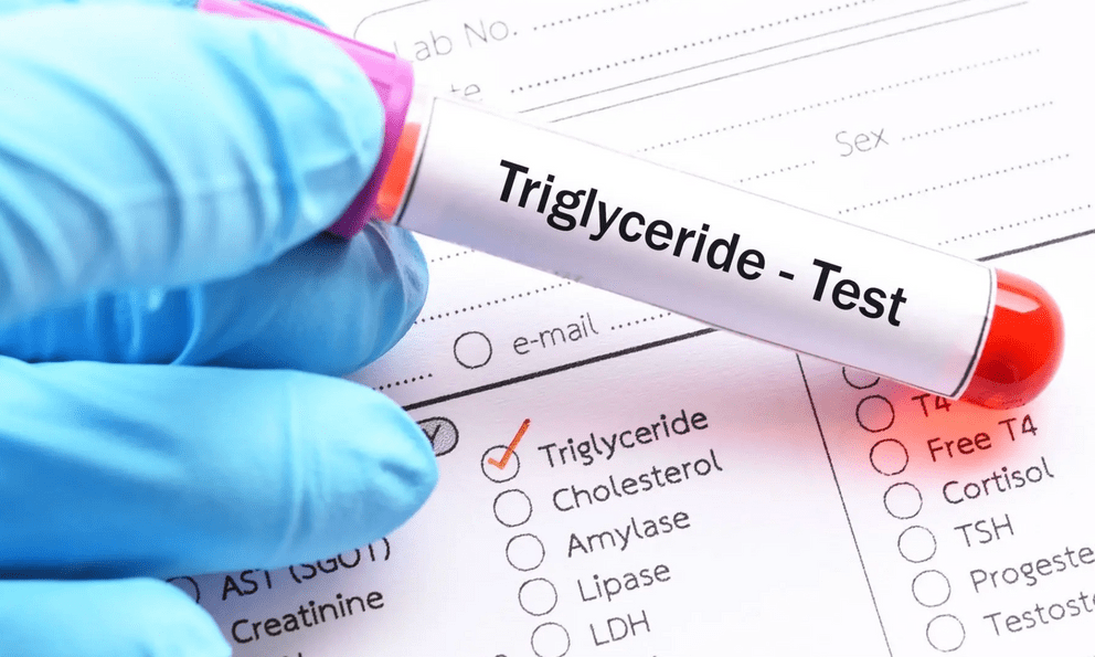 Người đàn ông U40 máu trắng đục như sữa, bác sĩ chỉ đích danh sai lầm khiến mỡ máu tăng vọt