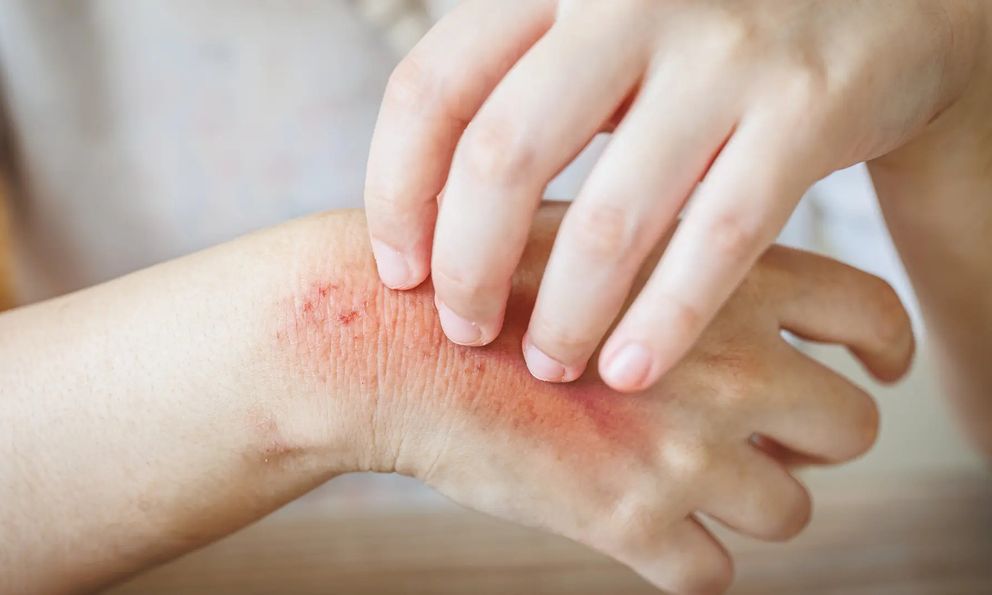 Muốn biết thận khỏe hay không, cứ nhìn vào da sẽ rõ: Đây là 7 dấu hiệu nếu có cần đi khám ngay