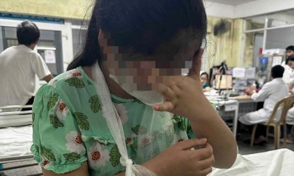 Cô giáo dùng thước gỗ đánh gãy tay học sinh lớp 4: Gia đình tiết lộ nguyên nhân