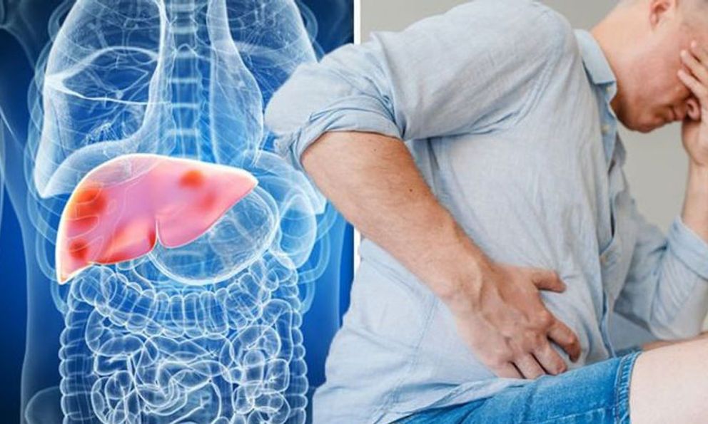 Gan xơ hóa, nhiễm mỡ độ 2 sau 25 năm duy trì 1 thói quen: Bác sĩ nói cần bỏ ngay