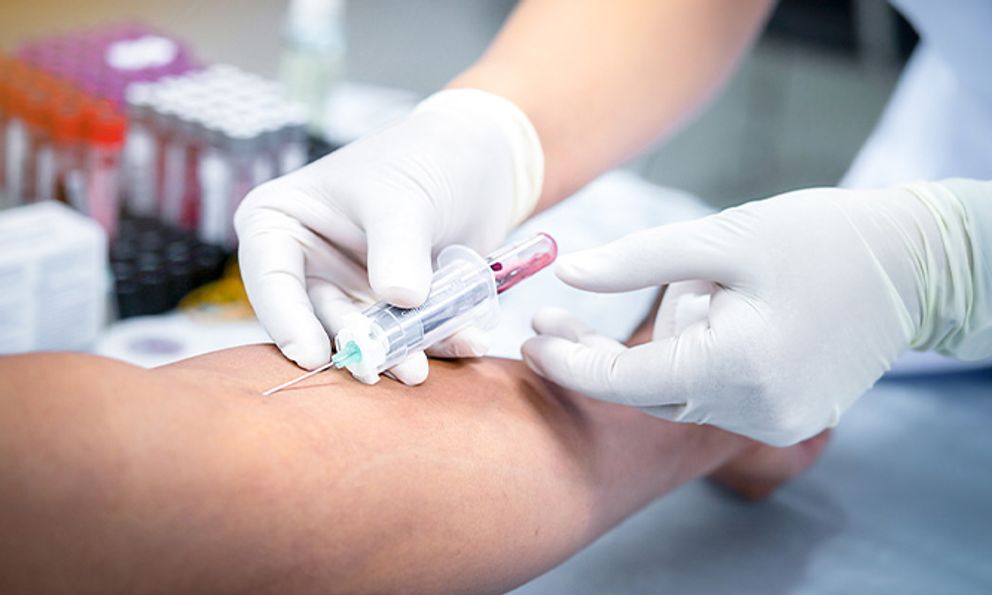 Bất cứ ai có 5 dấu hiệu này cần xét nghiệm máu ngay