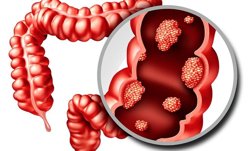 6 dấu hiệu cảnh báo đỏ của 