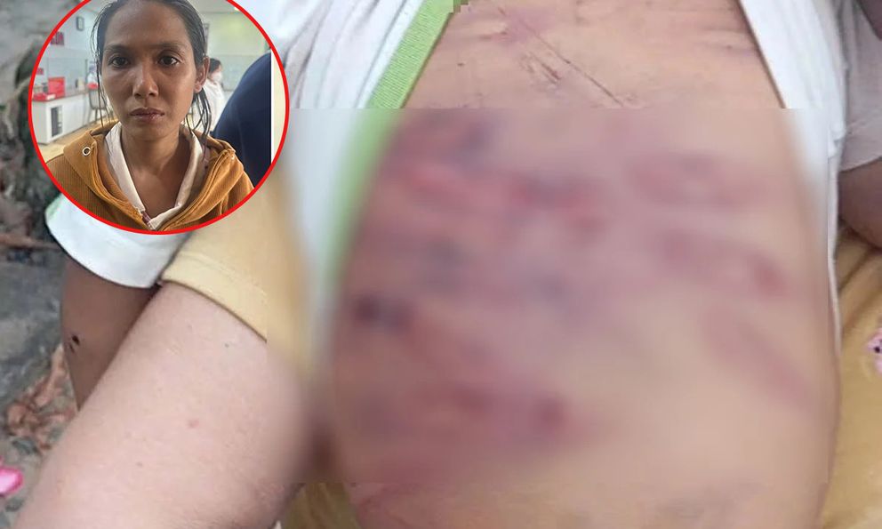 Bé 2 tuổi bị mẹ và cha dượng bạo hành dã man: Mẹ bế con sang hàng xóm xin tiền thì bị phát hiện