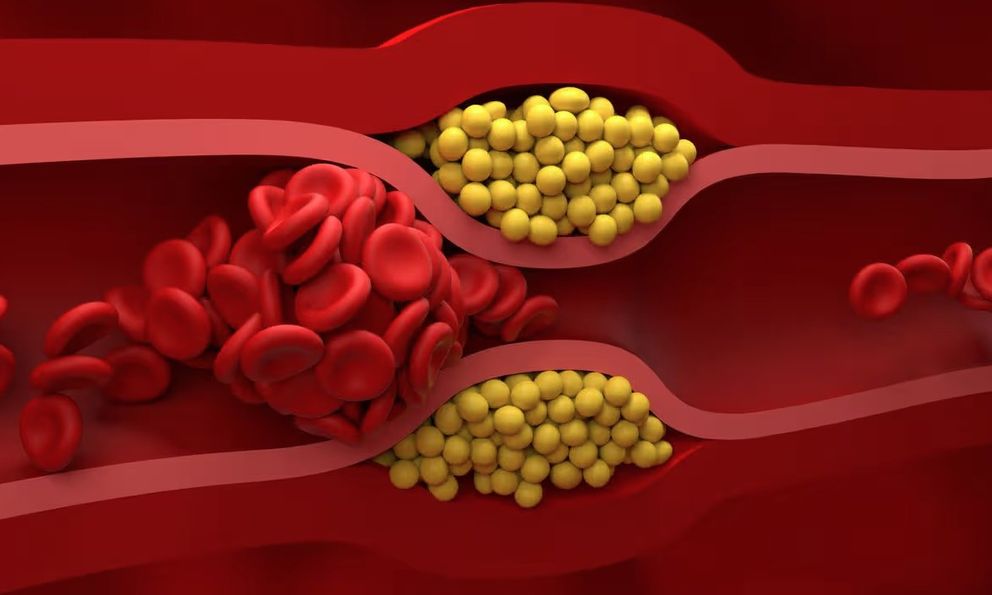 Không cần thực phẩm đắt tiền, bác sĩ chỉ 4 món quen thuộc giúp giảm cholesterol “cực đỉnh”