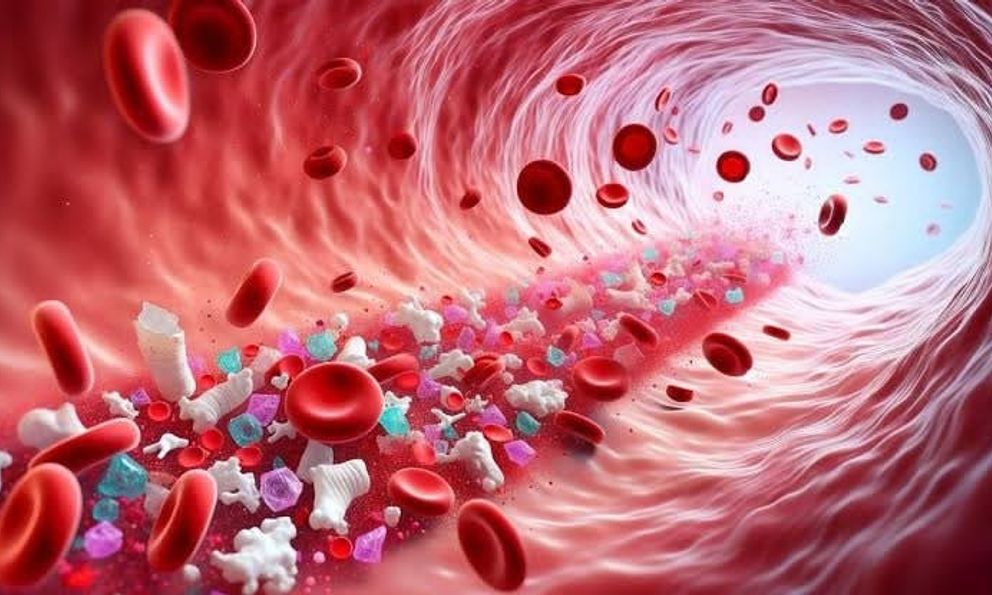 84% bệnh nhân nhồi máu cơ tim có vi nhựa trong máu, nghiên cứu mới hé lộ mối liên hệ đáng lo
