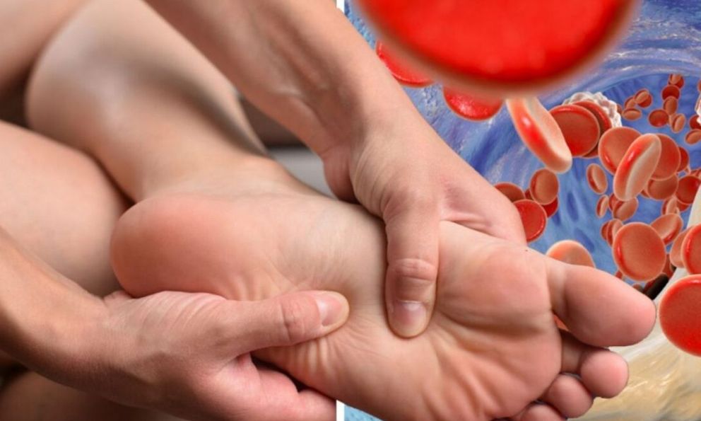 5 dấu hiệu cảnh báo acid uric đang cao vượt ngưỡng: Có 1 cũng cần cẩn thận kẻo gout sớm 