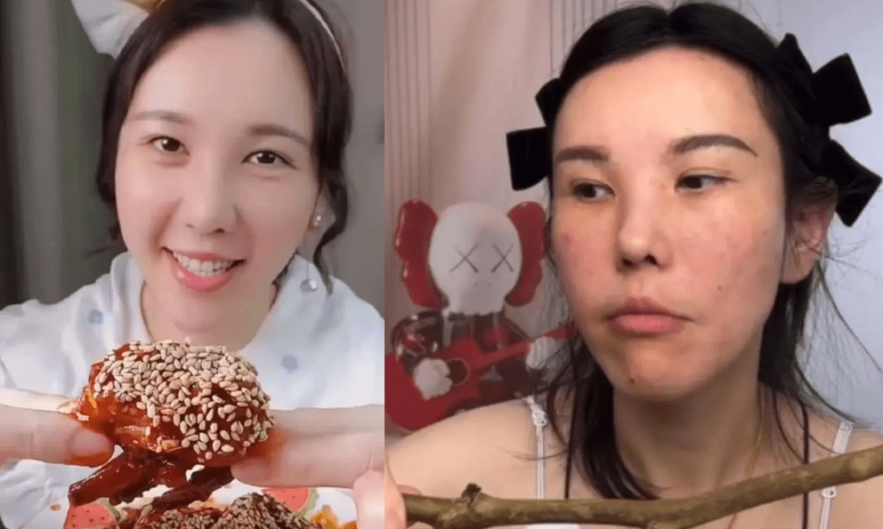 Mặt cô gái biến dạng sau 2 năm làm mukbang