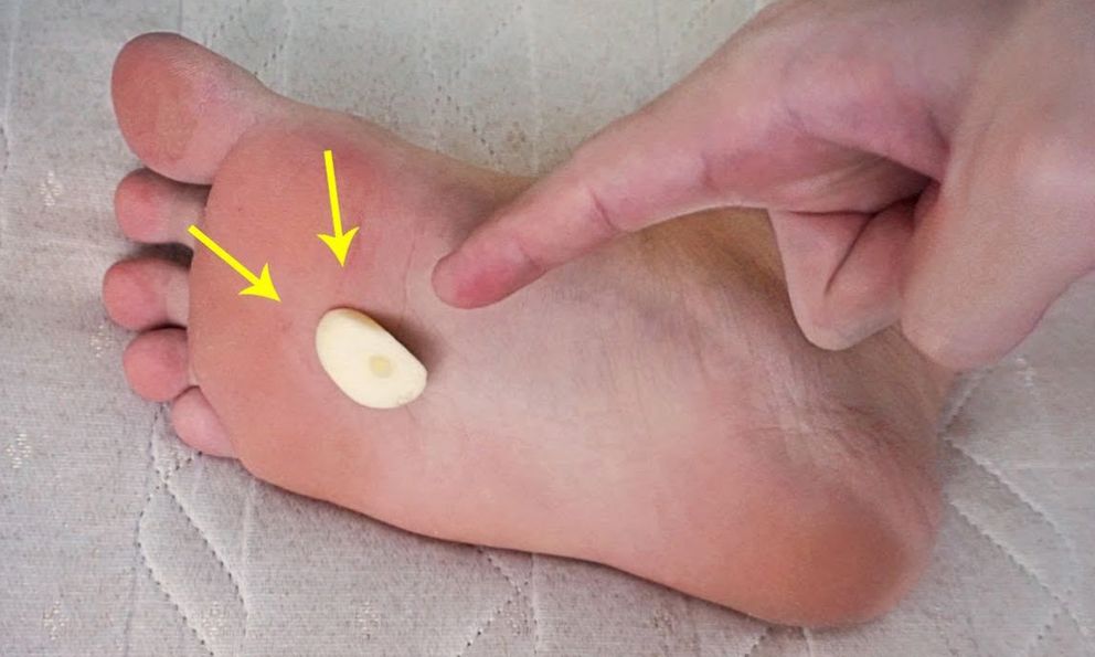 Chà tỏi lên lòng bàn chân, tưởng “vô tri” nhưng mang lại cá tá lợi ích sức khỏe, làm đẹp