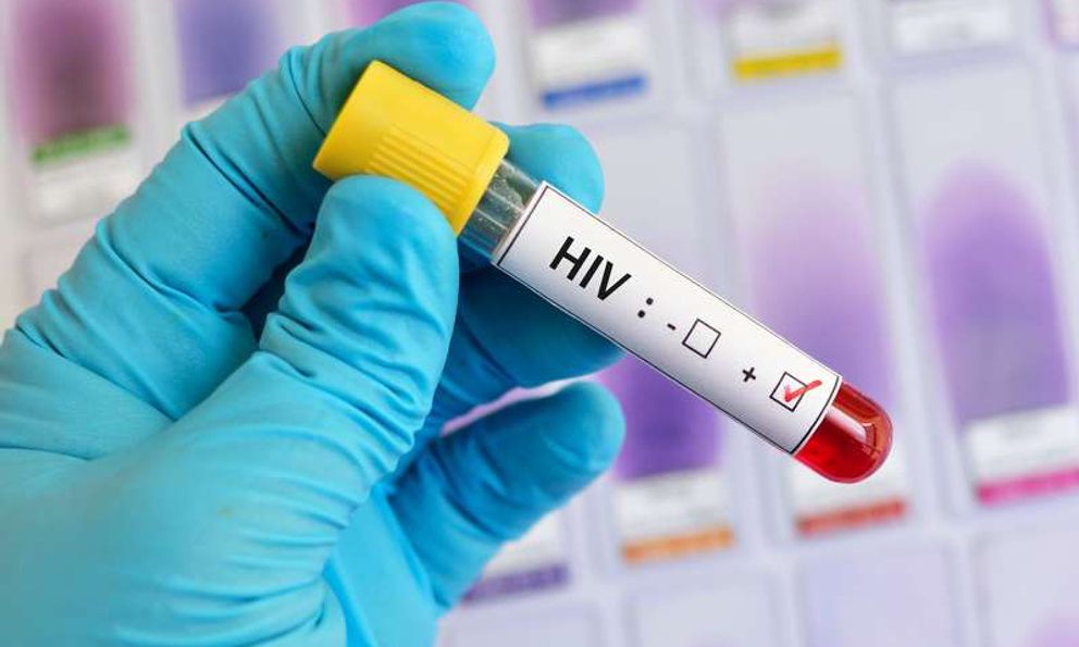 Nhiễm HIV không phải dấu chấm hết, có 6 việc bạn cần làm để mở ra “chương mới” cuộc đời