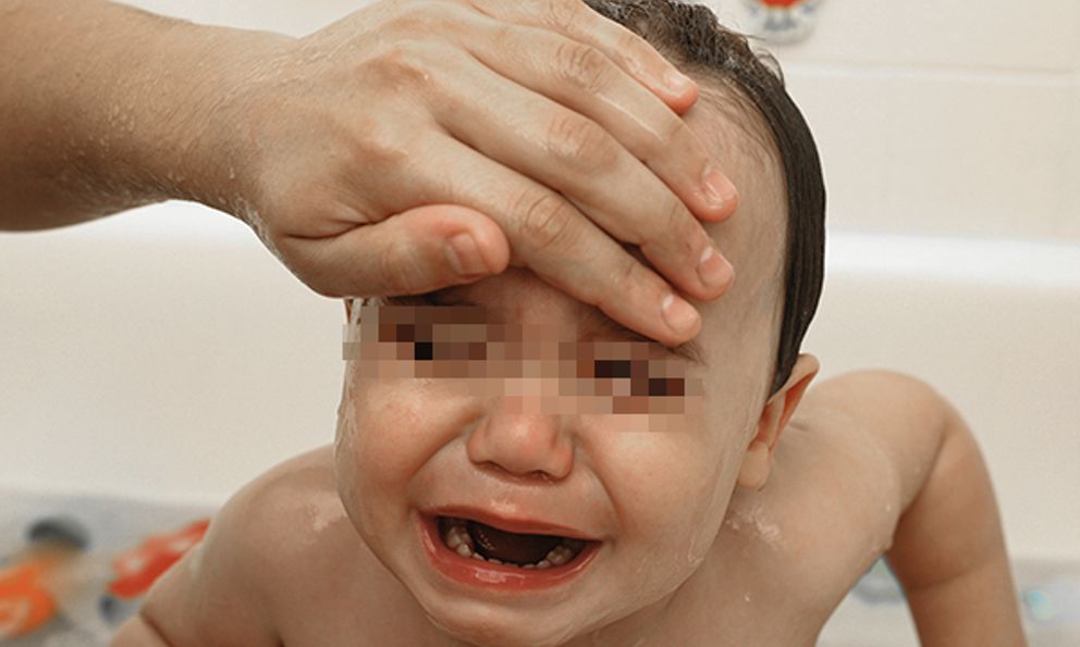 Trẻ em đang gặp những vấn đề sức khỏe nào thì không nên tiêm vắc xin sởi?