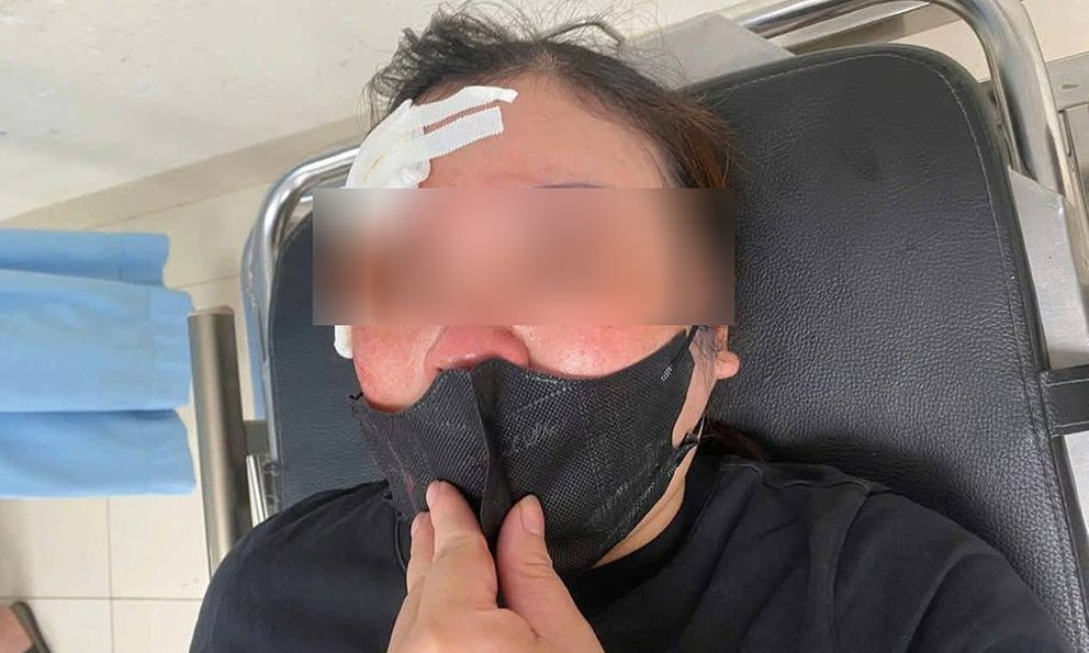 Hà Nội: Người phụ nữ tố bị tài xế ô tô dùng dùi cui đập chảy máu đầu khi đang nghe điện thoại, chưa thể tránh đường