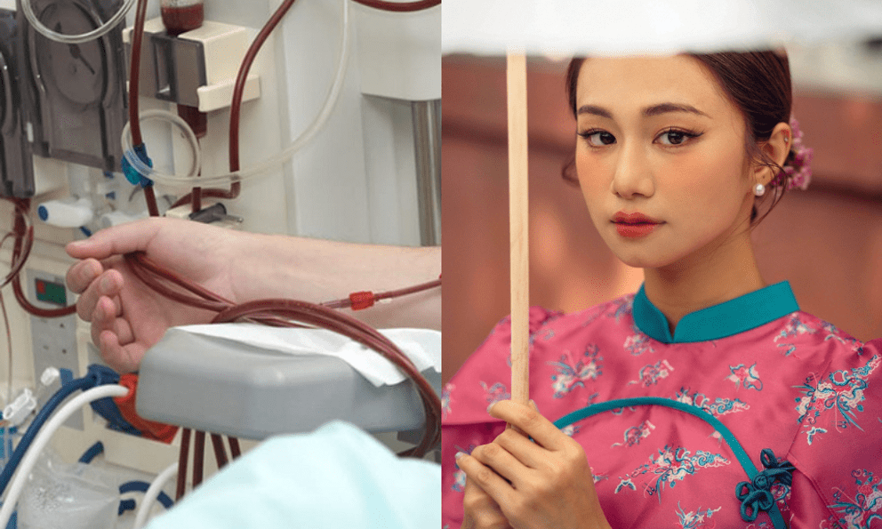 “Suy thận” trở thành từ khóa nóng sau trường hợp nữ diễn viên Ngân Hòa: Căn bệnh đang trẻ hóa đáng báo động