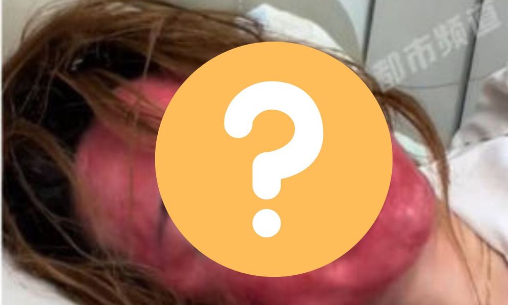 Khuôn mặt của người phụ nữ 22 năm không tẩy trang gây sốc