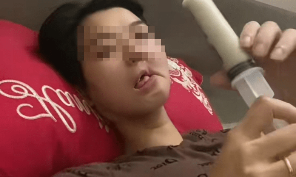 Hình ảnh cô gái mắc ung thư xương hàm, bữa ăn hàng ngày là 