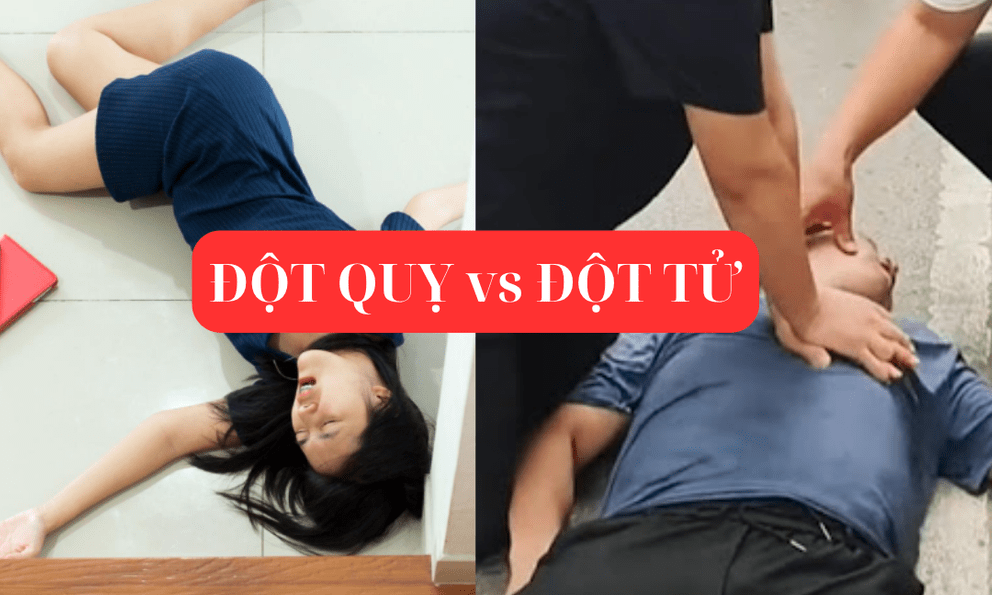 Cách phân biệt ĐỘT QUỴ với ĐỘT TỬ, tưởng 