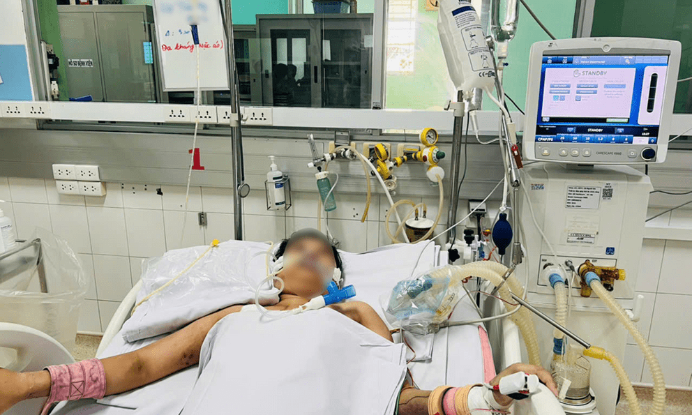 2 bệnh nhân trẻ ở TP.HCM suy đa cơ quan, nguy kịch vì sốt xuất huyết nặng