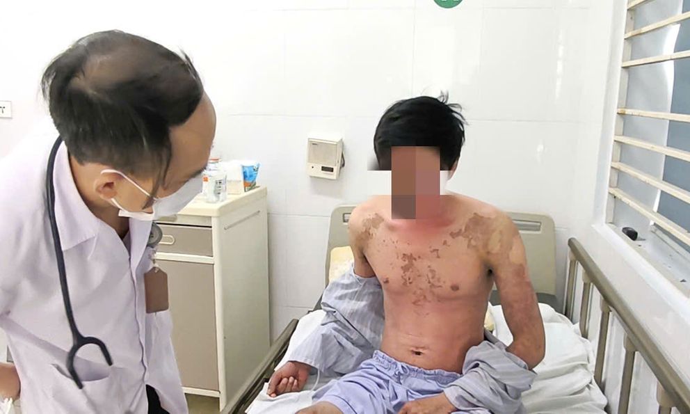 Đứng dưới mái hiên sau khi thi công chống dột, người đàn ông bị silicon “tấn công” toàn thân