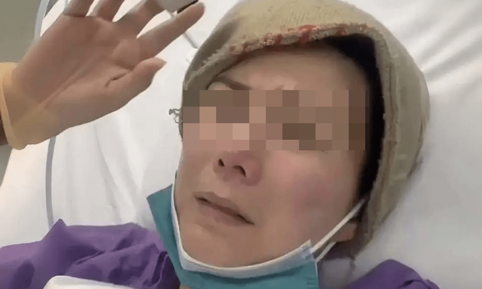 Nữ giáo viên 27 tuổi phát hiện ung thư vú giai đoạn 2 vì chủ quan 