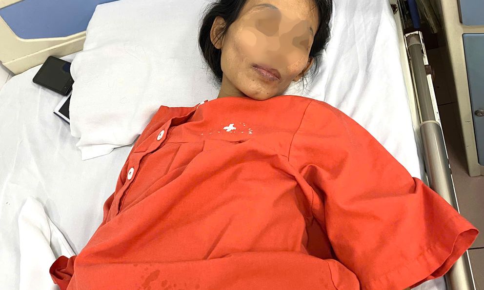 Hai vợ chồng cùng nằm viện, người vợ mang khối u tử cung 