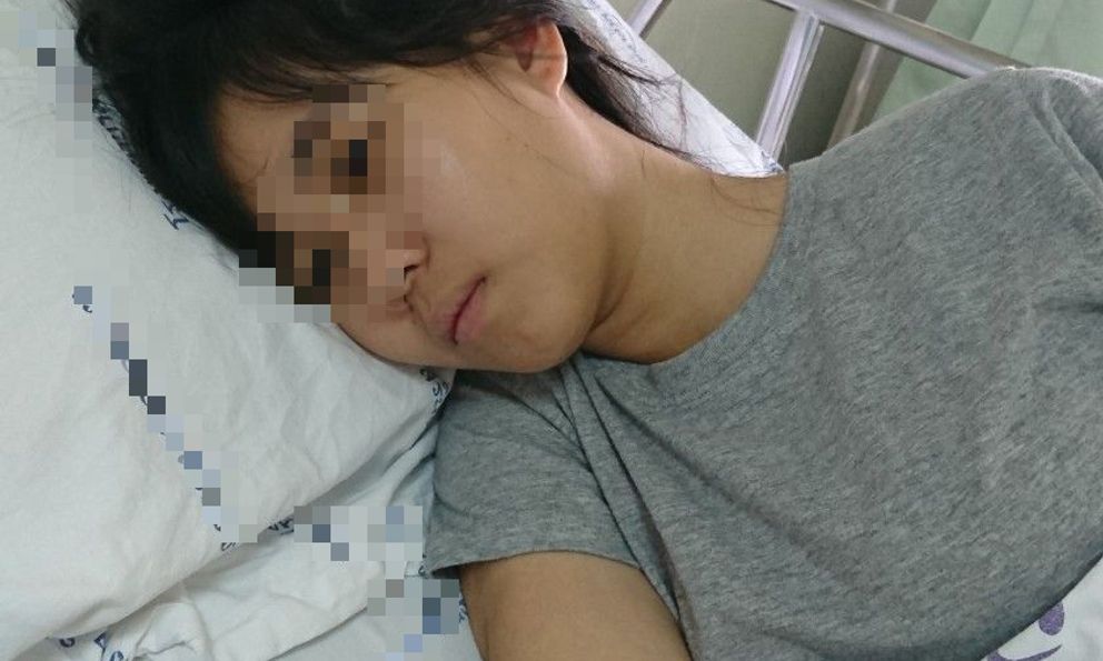 Ung thư đại trực tràng ngày càng thích 