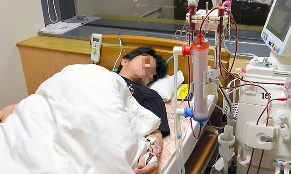 Người đàn ông phát hiện suy thận nhờ đi khám phù chân, bác sĩ sửng sốt: 