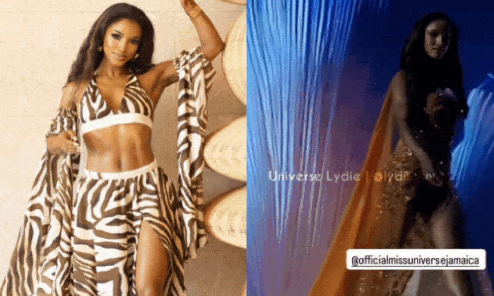 Hoa hậu gặp nạn ở Miss Universe chuyển biến xấu, đang nằm hồi sức tích cực 