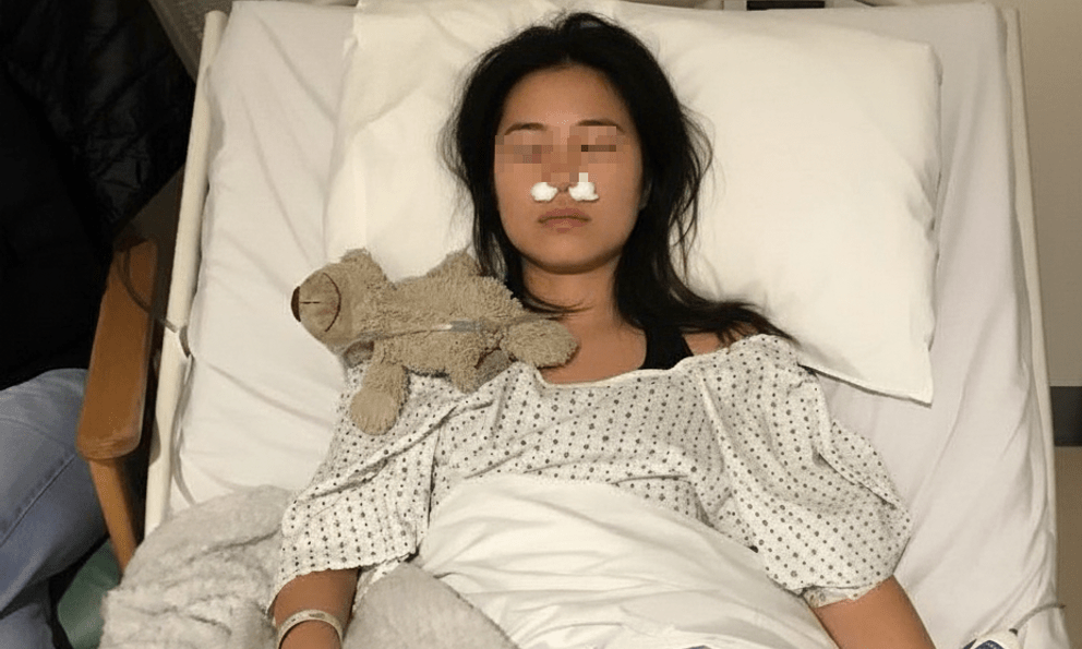 Người phụ nữ mọc cả đống nấm trong mũi vì 1 hành động 