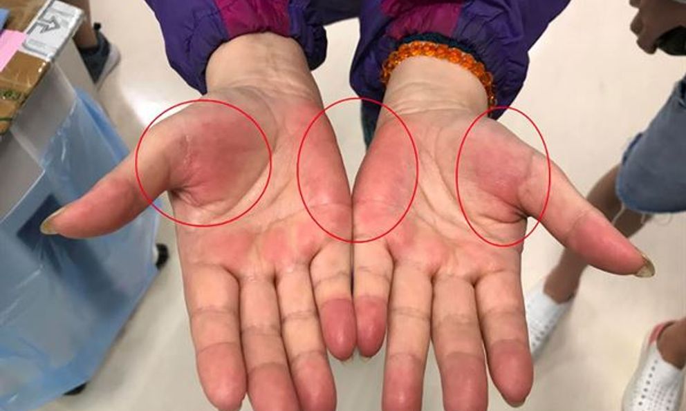 Nếu thường xuyên có 7 cảm giác này, rất có thể nhiều bệnh ung thư đang 