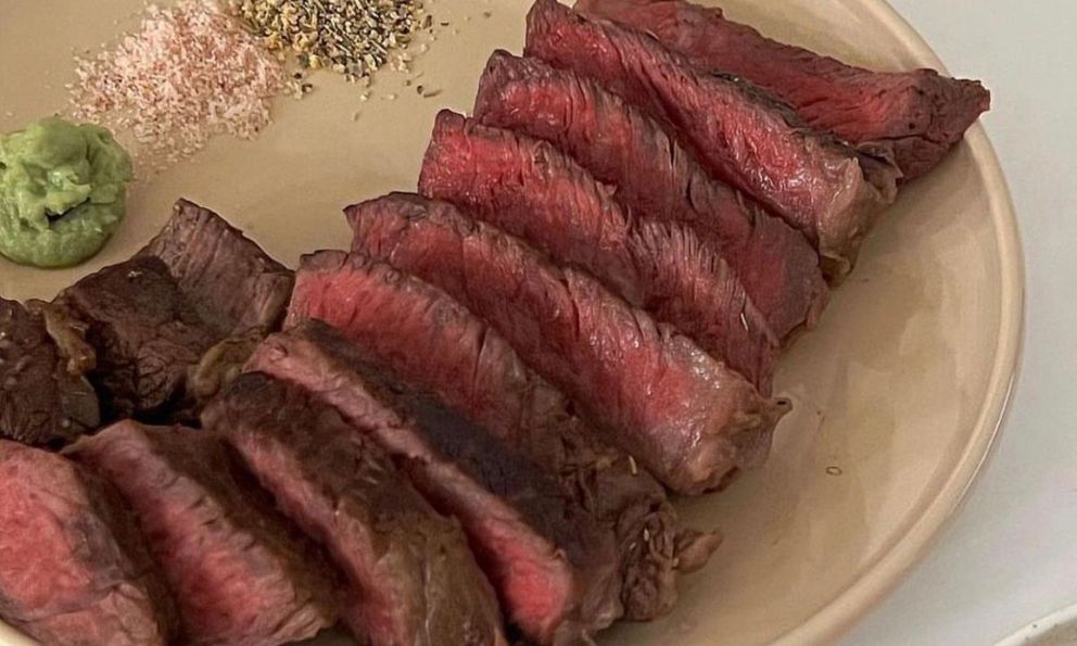 Kỳ lạ người phụ nữ ăn thịt bò mỗi ngày để… giảm mỡ máu, 3 tháng sau bác sĩ cũng phải bất ngờ khi tái khám