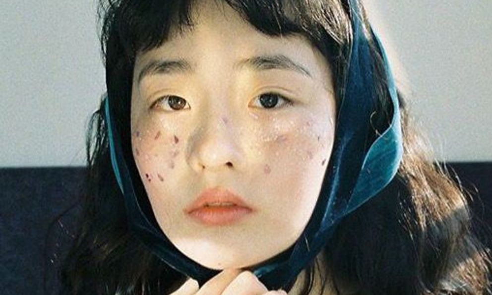 7 vị trí trên cơ thể thường chuyển sang MÀU ĐEN khi ung thư xuất hiện, tự kiểm tra ngay!