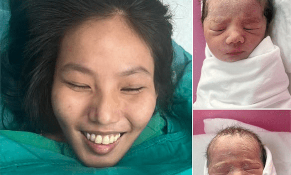 Mẹ bầu nuôi tạm bàn tay ở cẳng chân đã sinh con an toàn