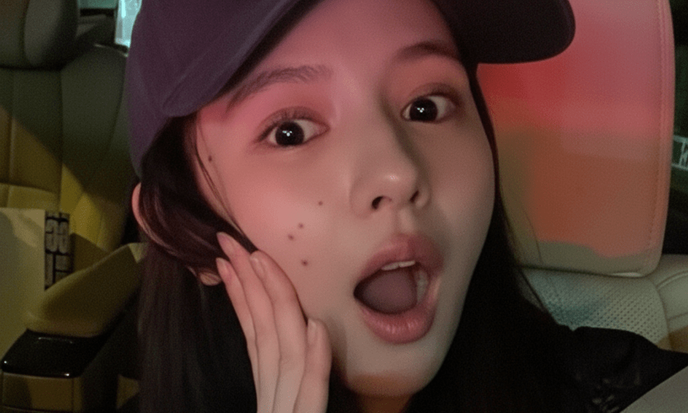 Ngỡ ngàng với clip mô tả dấu hiệu cảnh báo khối u ác tính, có thể xuất hiện trên da trước 10 năm mà nhiều người không nhận ra