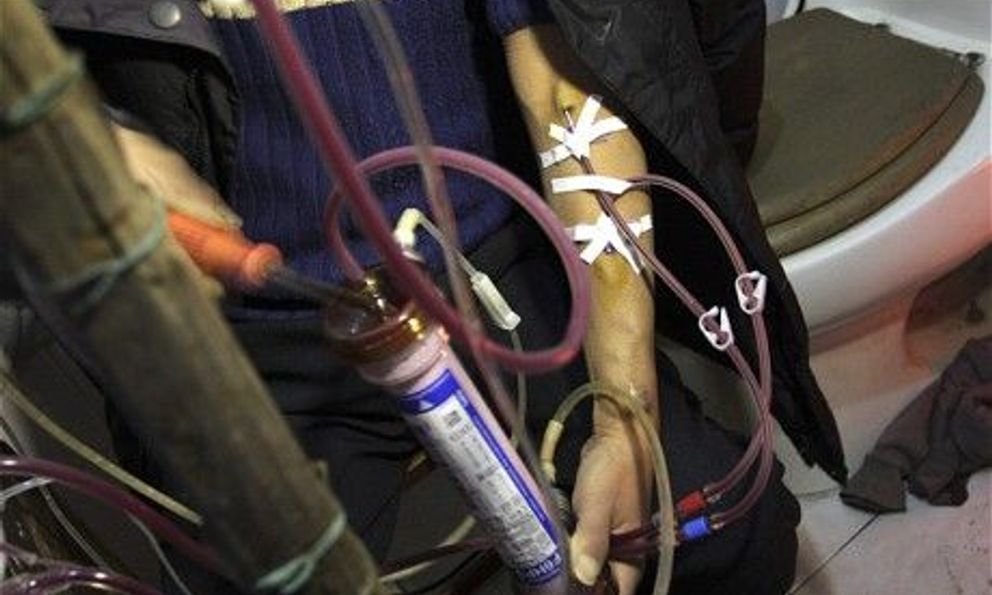 Nam kỹ sư 26 tuổi đột ngột phát hiện suy thận giai đoạn 4 kể: 