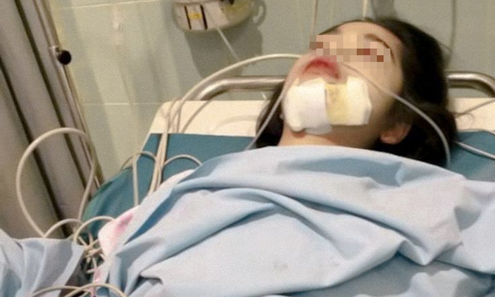 Ngày càng nhiều người chết vì ung thư vòm họng? Bác sĩ cảnh báo: Có 5 nhóm người bị liệt vào danh sách 