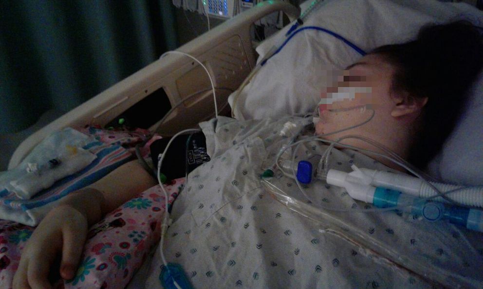 Người phụ nữ lên cơn đột quỵ nguy kịch giữa đêm đông chỉ sau một cuộc cãi vã