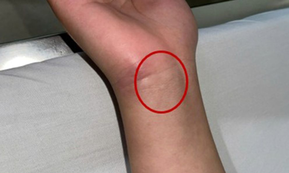 Bệnh viện Trung ương Quân đội 108 phát cảnh báo về 1 căn bệnh nguy hiểm, nhà nào cũng có nguy cơ mầm mống trú ngụ