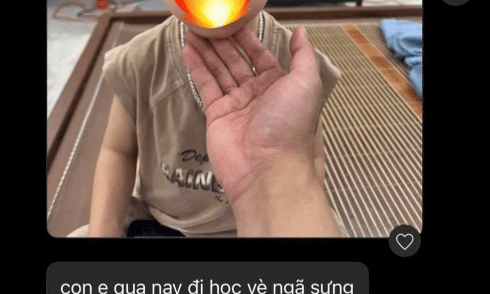 Con đi học về bị ngã sưng tím, phụ huynh nhắn tin 