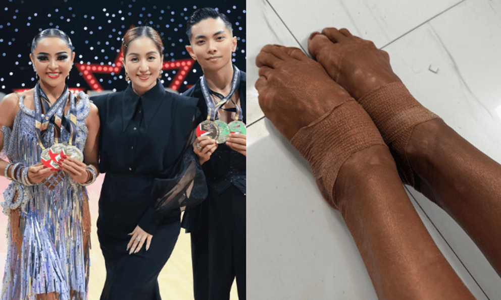 Cận cảnh đôi chân rớm máu, băng bó chằng chịt của kiện tướng Thu Hương khi cùng Phan Hiển giành 3 HCV Đông Nam Á