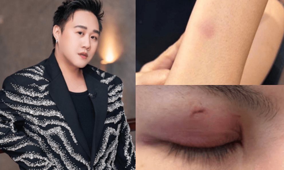 Mới nhất drama hành hung nữ bác sĩ: Trung Quân thông báo ngưng hoạt động rồi xoá post sau 10 phút