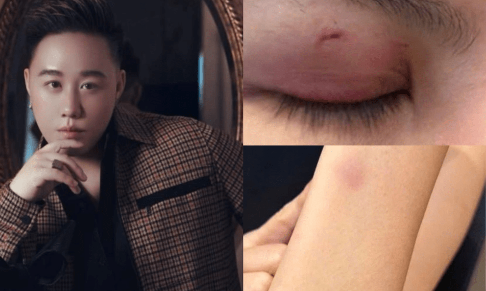 Ca sĩ Trung Quân Idol bị tố hành hung phụ nữ: Luật sư nói gì về trách nhiệm pháp lý?