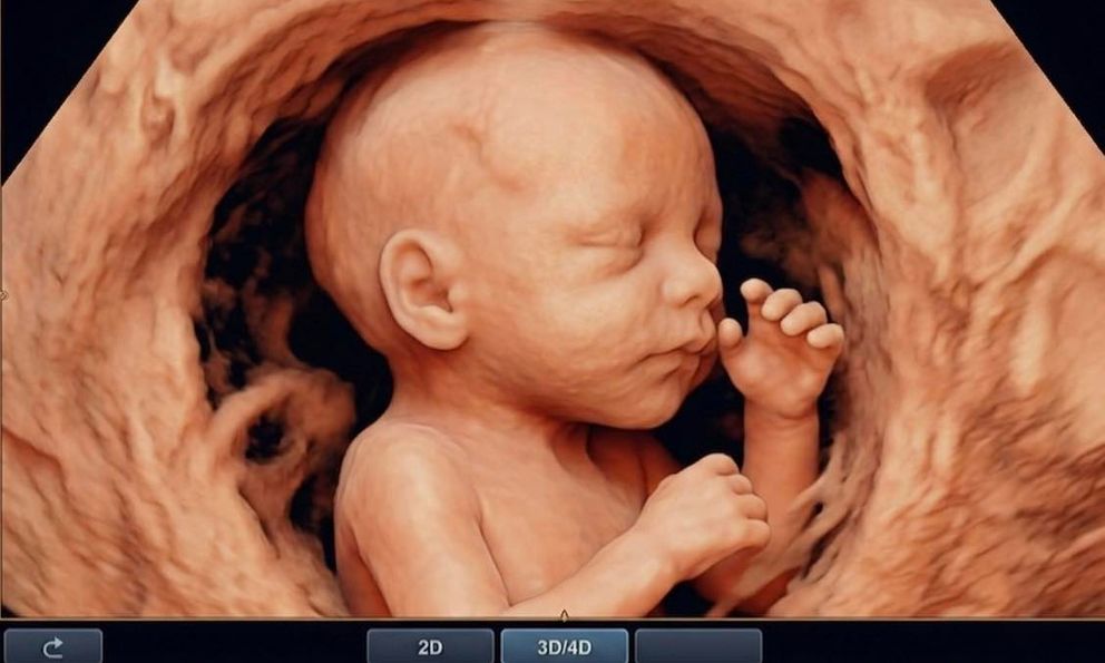 Bác sĩ nghẹn lòng trước mong muốn của sản phụ: 