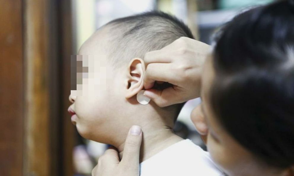 Bé 7 tuổi ở TP.HCM bị rối loạn tâm thần cấp tính: Bác sĩ phát hiện thủ phạm đến từ miếng dán chống say tàu xe
