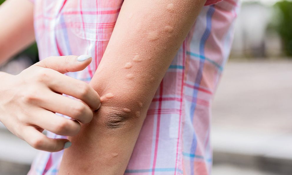 Các phản ứng dị ứng và miễn dịch sau tiêm vắc-xin: Bác sĩ Bệnh viện Bạch Mai khuyên 