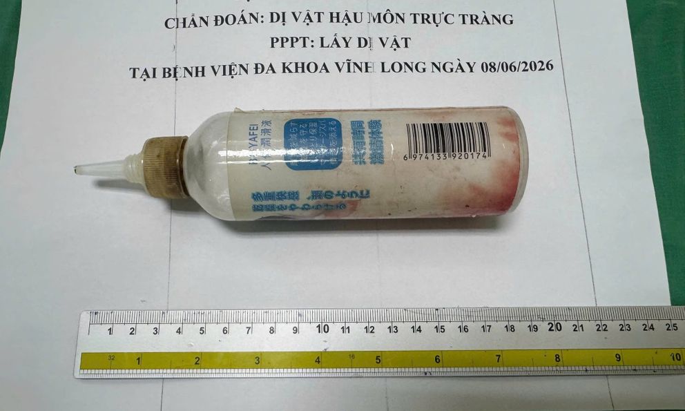 Chai nhựa 20cm mắc kẹt trong trực tràng người đàn ông 34 tuổi