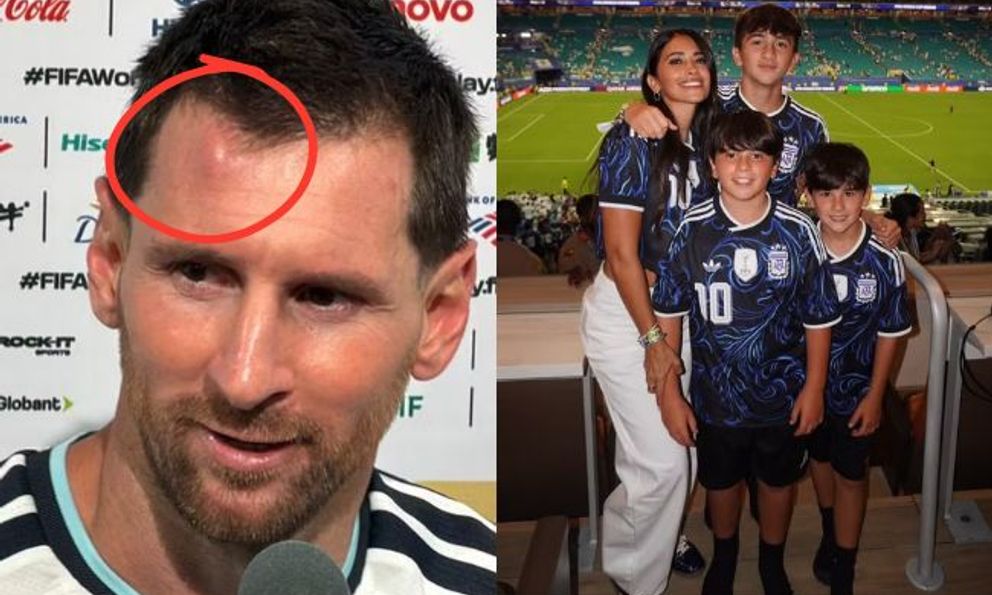 Messi sưng u đầu, được vợ đẹp con ngoan động viên sau chiến thắng nhọc nhằn của Argentina trước Cape Verde