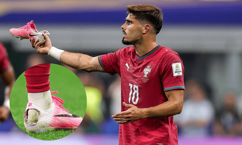 Ngôi sao Bồ Đào Nha đi giày rách toác gót thi đấu ở World Cup 