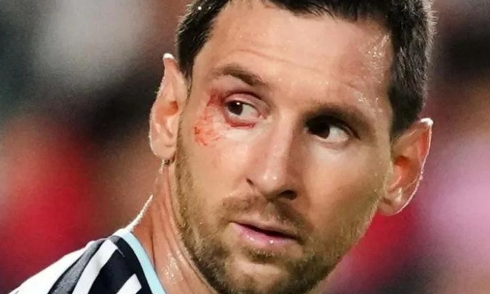 Vì sao Messi 