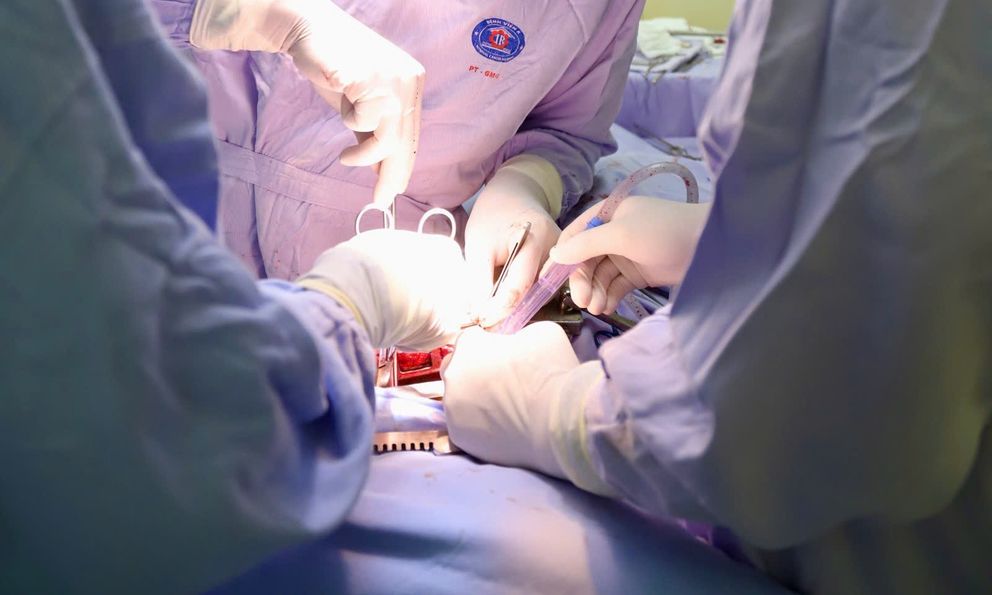 Xem nhẹ cơn ho, người đàn ông phát hiện ung thư phổi sau 30 năm làm 1 việc cực quen nhưng cực hại