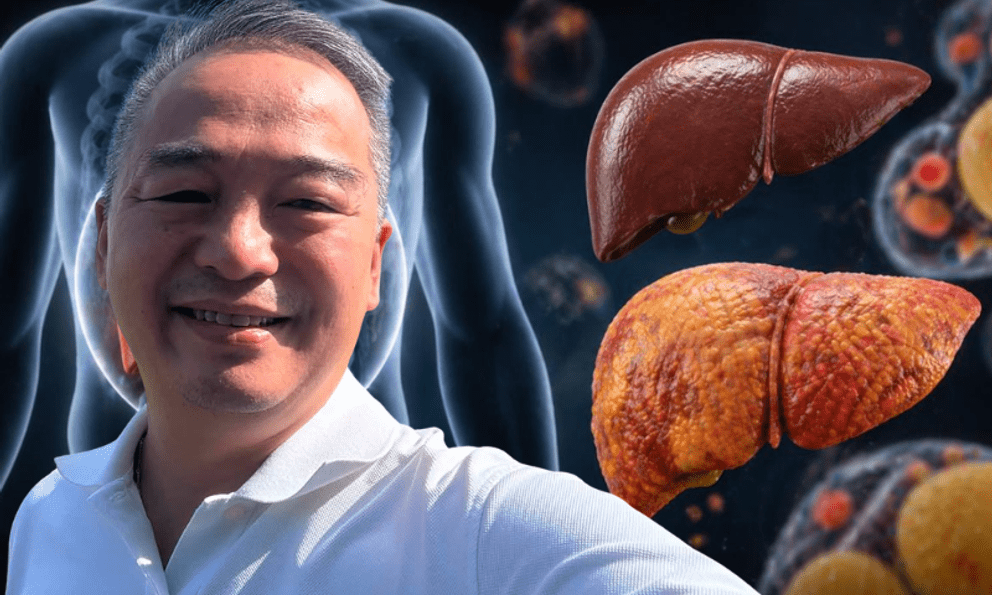Lời khuyên của Giám đốc Bệnh viện Đại học y Hà Nội đến người bị gan nhiễm mỡ